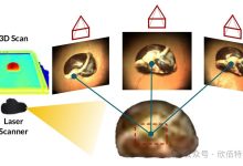 在微创手术中使用Kinova轻型机械臂进行多视图图像采集和3D重建-网硕互联帮助中心